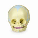 Human Fetal Skull